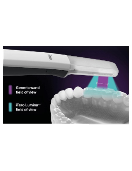 iTero Lumina Escáner Intraoral