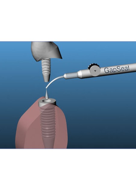 Gapseal Sellador para Implantes Kit Reposición 10 Tips 0,06ml Hager Werken