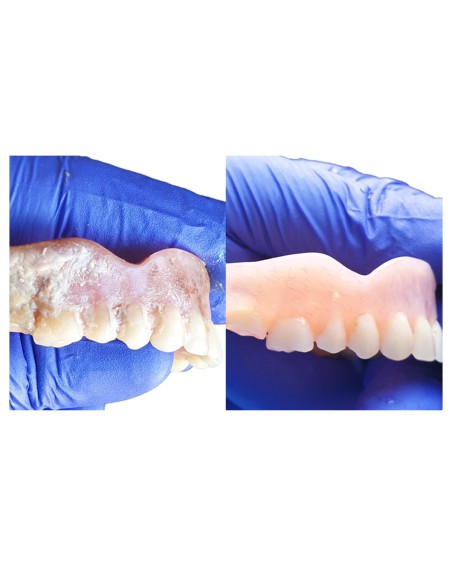 Sympro Aparato para la Limpieza de Prótesis y Ortodoncias Renfert