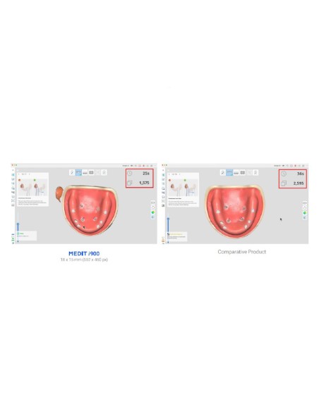 Medit i900 Escáner Intraoral, 360º Touch Band, Sin Botones