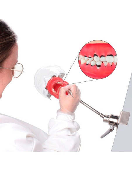 Fantoma Periodontal con Tipodonto de 28 Dientes, Anclaje a Mesa Bader