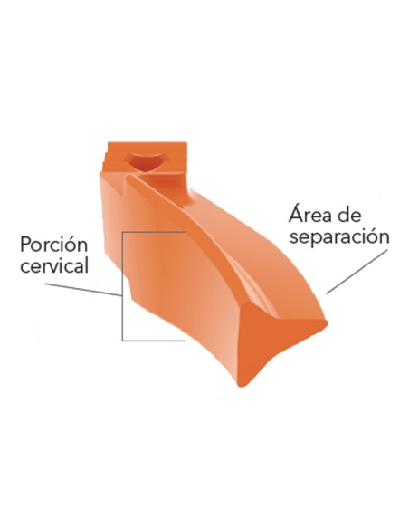 Cuñas Anteriores Fusion Kit Surtido 200 uds Garrison