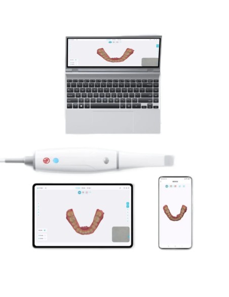 Escáner intraoral Smile Scan KP Woodpecker