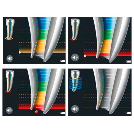 Raypex 6 - Localizador de Ápices de VDW