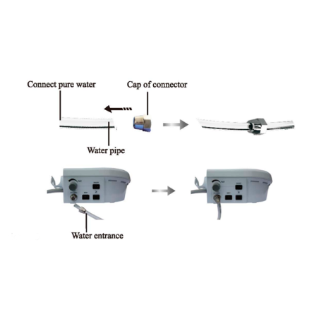DTE-D5 Aparato de Ultrasonidos para Limpieza Bucal