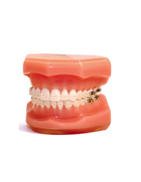 Arco NiTi Super Elástico Estético Redondo Oval Form 5u