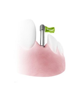 Módulo Osstell ISQ para Implantmed 2