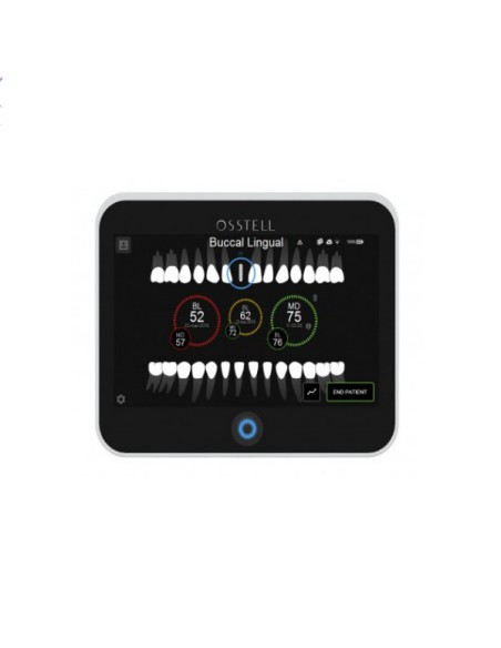 Osstell IDx Medidor de Estabilidad