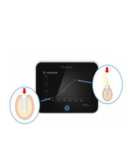 Osstell IDx Medidor de Estabilidad