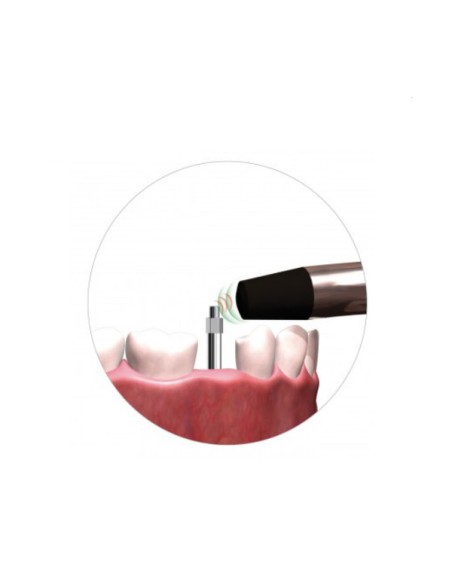 Osstell IDx Medidor de Estabilidad