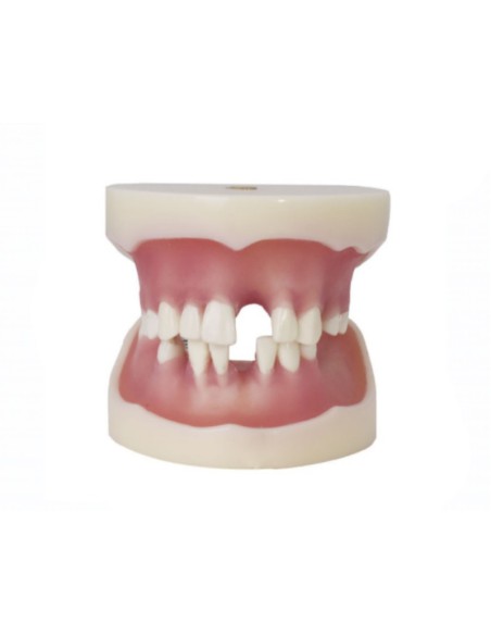 Tipodonto para Implantología Articulado