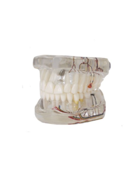 Modelo Dental Transparente de Implante con Nervio