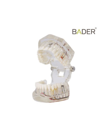 Modelo Dental Transparente de Implante con Nervio