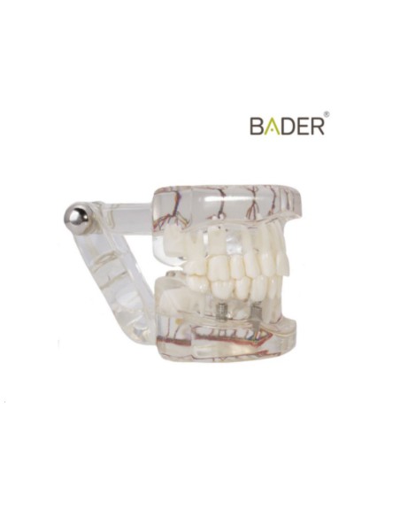 Modelo Dental Transparente de Implante con Nervio