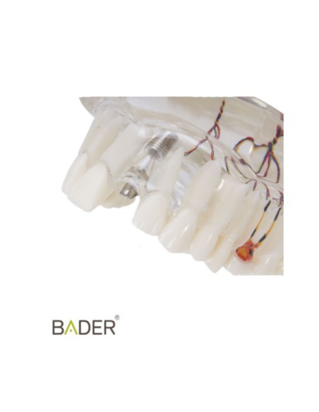 Modelo Dental Transparente de Implante con Nervio