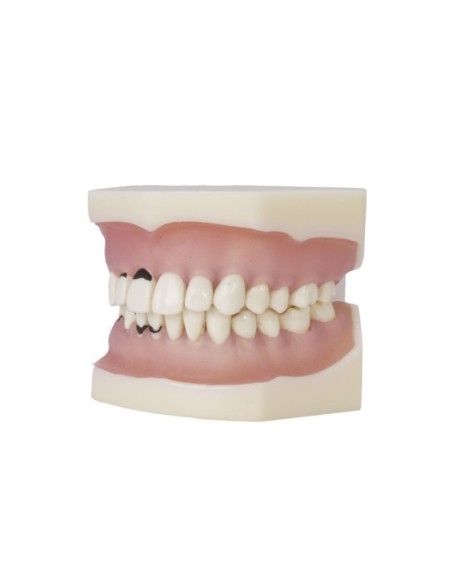 Tipodonto de Periodoncia