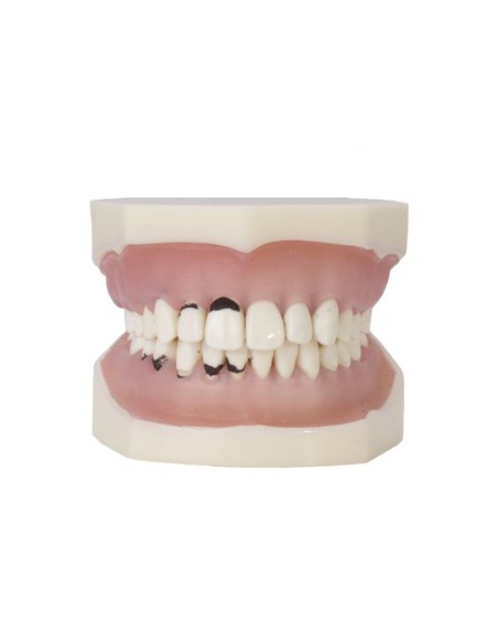 Tipodonto de Periodoncia