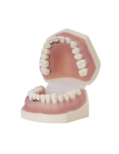 Tipodonto de Periodoncia