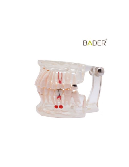Modelo Dental Transparente de Implante 31 Dientes