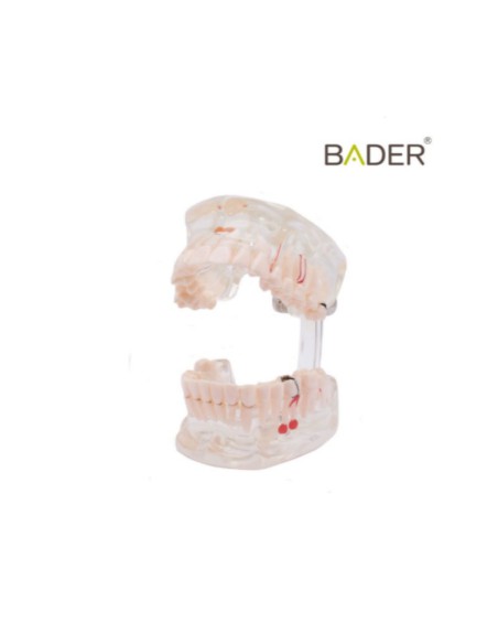 Modelo Dental Transparente de Implante 31 Dientes