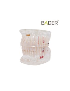 Modelo Dental Transparente de Implante 31 Dientes
