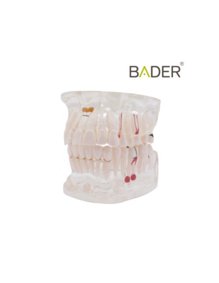 Modelo Dental Transparente de Implante 31 Dientes