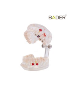 Modelo Dental Transparente Caries 32 Dientes 2